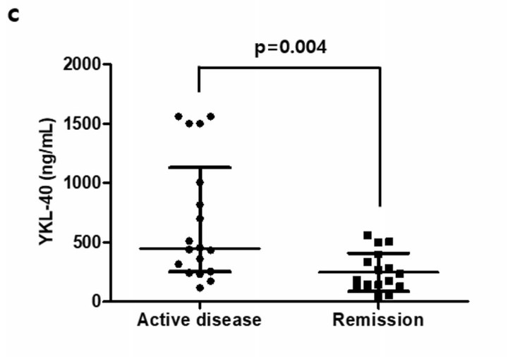 Imperial College London에서 분석한 질병 활성기(왼쪽)와 관해기(오른쪽) 상태에서의 혈청 YKL-40 수치. ⓒ 세브란스